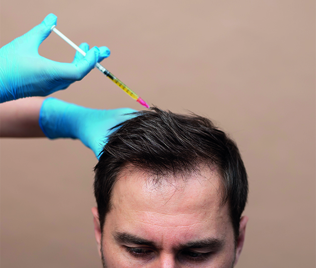 PRP ile Sa&ccedil; D&ouml;k&uuml;lmesi Tedavisi: Ger&ccedil;ekten İşe Yarıyor mu?